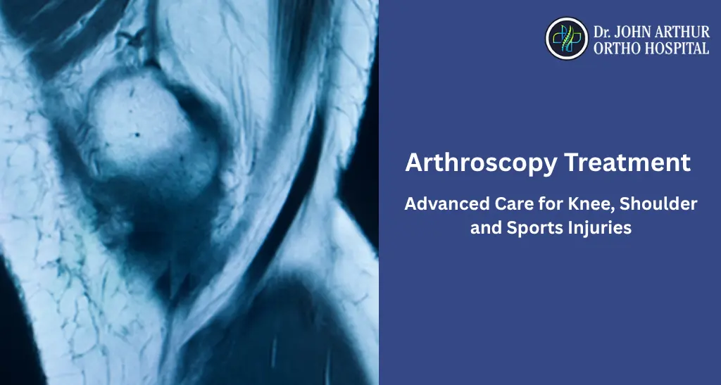 Arthroscopy Treatment in Chennai: Advanced Care for Knee, Shoulder and Sports Injuries