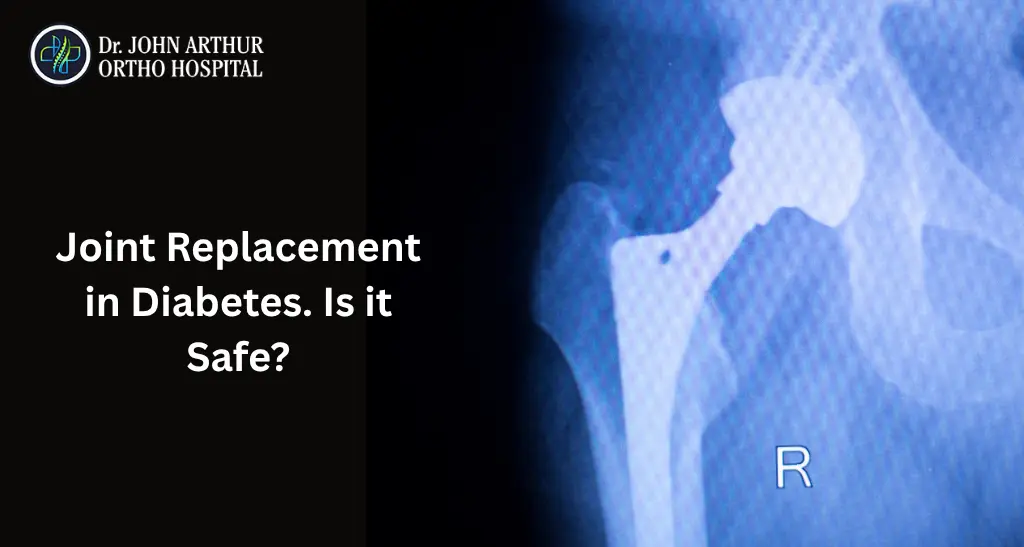 Joint Replacement in Diabetes: Is It Safe?